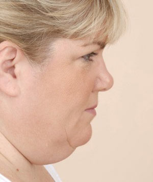 https://arshanclinic.com/suction-ghabghab/