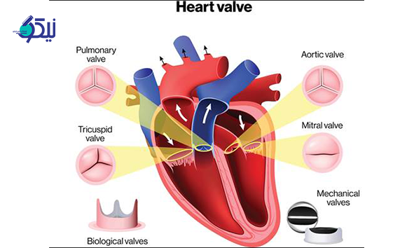 مشکلات دریچه قلب 